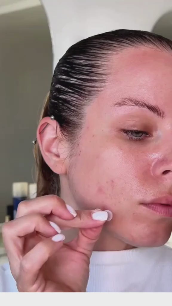 Pimpli™ - Hydrocolloid Acne Patches video